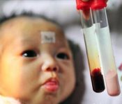 Top 7 những trái cây nên ăn khi bị mụn