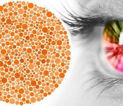 Bệnh mù màu và những điều bạn nên biết
