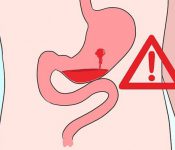 Top 7 những trái cây nên ăn khi bị mụn