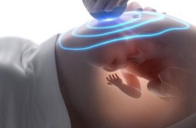 Siêu âm nhiều có ảnh hưởng đến thai nhi hay không
