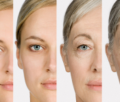 Top 7 những trái cây nên ăn khi bị mụn