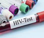 HIV là một trong các bệnh lây qua đường tình dục của thế kỷ.
