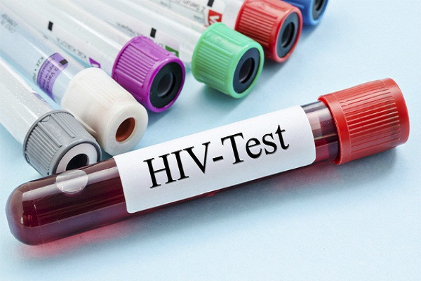 HIV là một trong các bệnh lây qua đường tình dục của thế kỷ.
